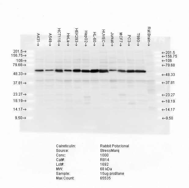 IHC-plus™ CALR / Calreticulin Antibody