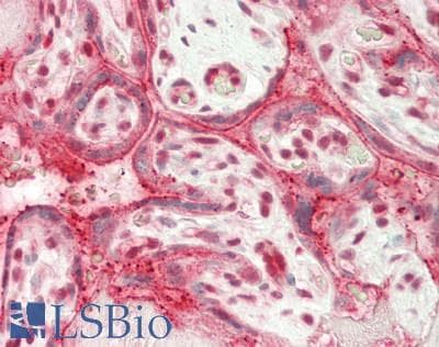 IHC-plus™ DICER1 / Dicer Antibody (aa600-650)