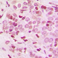 ARID1B / BAF250B Antibody (Internal)
