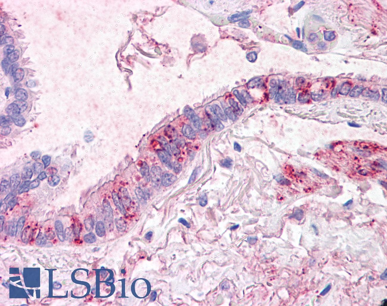 IHC-plus™ SLC31A1 / CTR1 Antibody (C-Terminus)