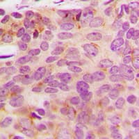 NDUFA3 / B9 Antibody (Internal)