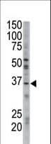 GGPS1 Antibody (aa16-46)