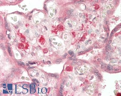 IHC-plus™ Polyclonal Rabbit anti-Human SNX20 Antibody (aa 1-102, IHC, WB)