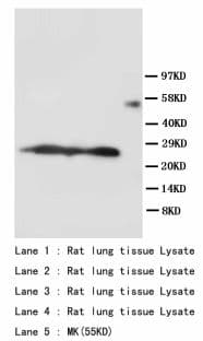 SFTPA1 / Surfactant Protein A Antibody (aa221-236)