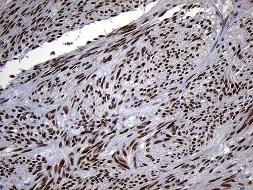 Monoclonal Mouse anti-Human RACGAP1 / MGCRACGAP Antibody (clone OTI3D8, aa123-238, IHC, WB)
