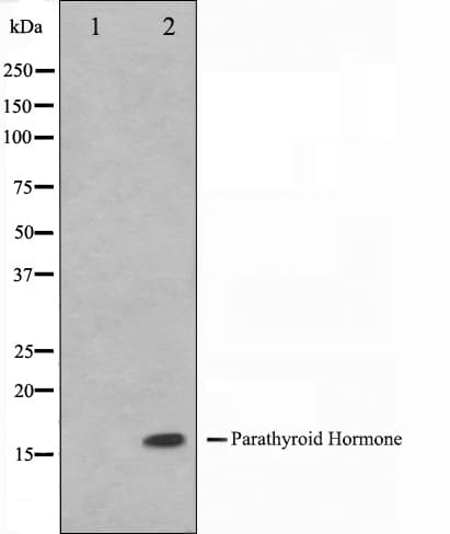 PTH / Parathyroid Hormone Antibody