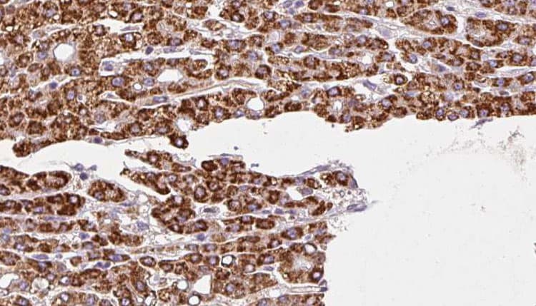 VN1R3 Antibody