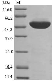 Human EEF1A1 Protein (Recombinant)