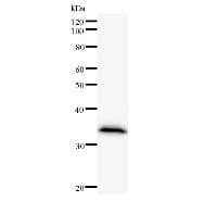 CIB2 / KIP2 Antibody (clone CIB2C12B11)