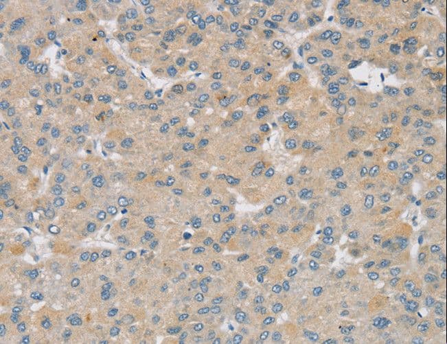 Polyclonal Rabbit anti-Human SMOC2 Antibody (aa 433-446, IHC, WB)
