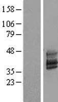 TMEM51 Protein (Over-Expression Lysate Myc-DDK (Flag))