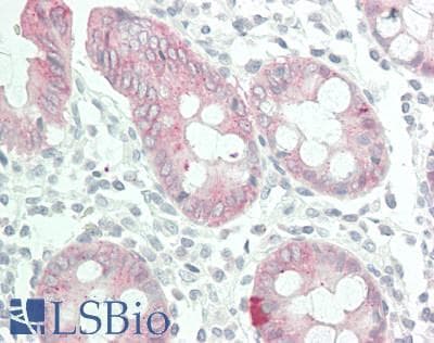 IHC-plus™ SFN / Stratifin / 14-3-3 Sigma Antibody