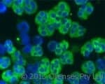 LL37 / Cathelicidin Antibody