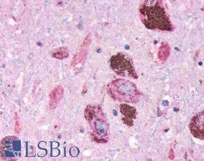 PathPlus™ ADGRE2 / EMR2 Antibody (N-Terminus)