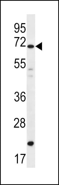 DAZ4 Antibody (aa90-119)