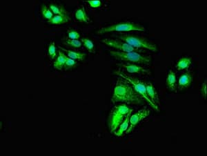 SEPX1 / Selenoprotein R Antibody