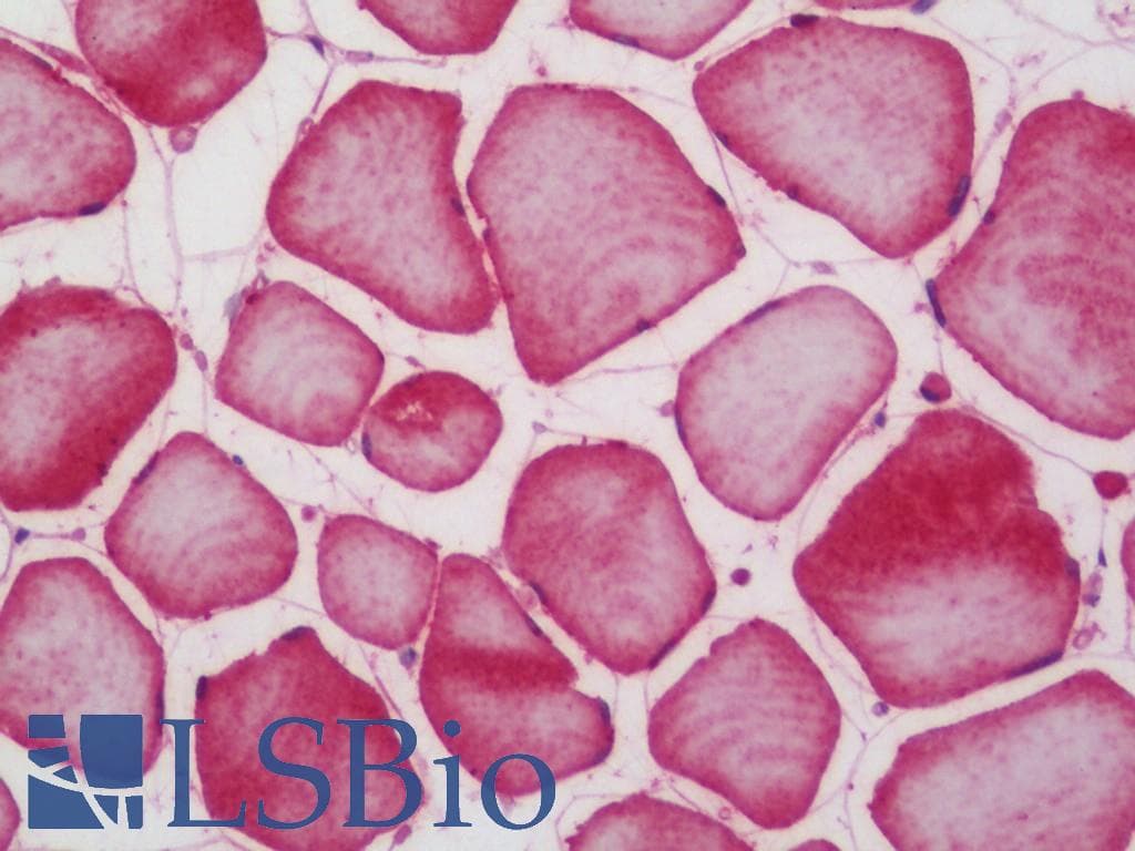 IHC-plus™ SCN2A / Nav1.2 Antibody (aa983-1032)