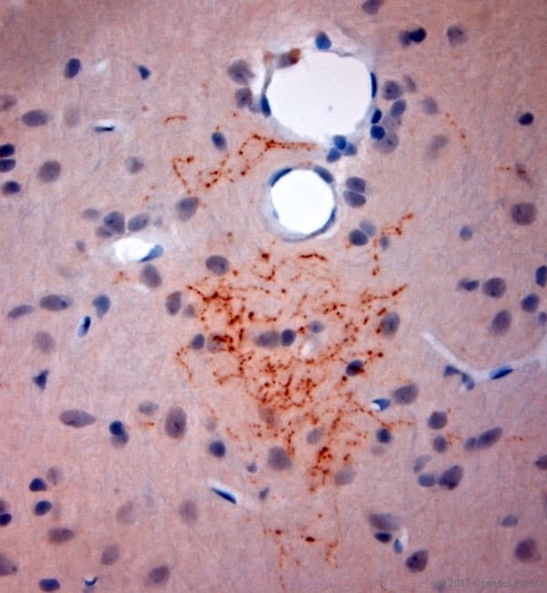 Polyclonal Rabbit anti-Rat SYNPO / Synaptopodin Antibody (aa890-930, IHC)