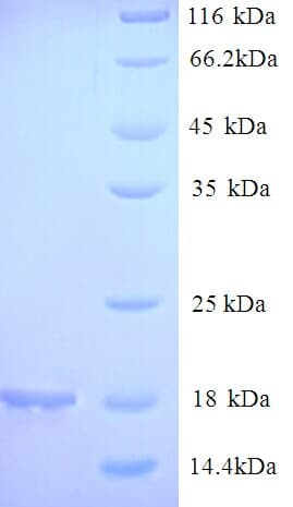 Soybean 2S Albumin Protein (Recombinant 6His, N-terminus)