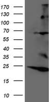 RNF144B Antibody (aa1-256, clone OTI10A12)