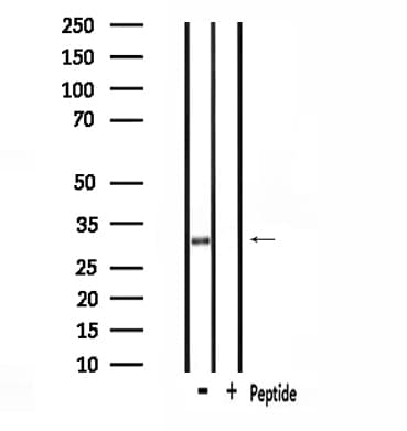 Polyclonal Rabbit anti-Human SMUG1 Antibody (IF, WB)
