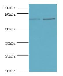 GUSB / Beta Glucuronidase Antibody (aa382-651)