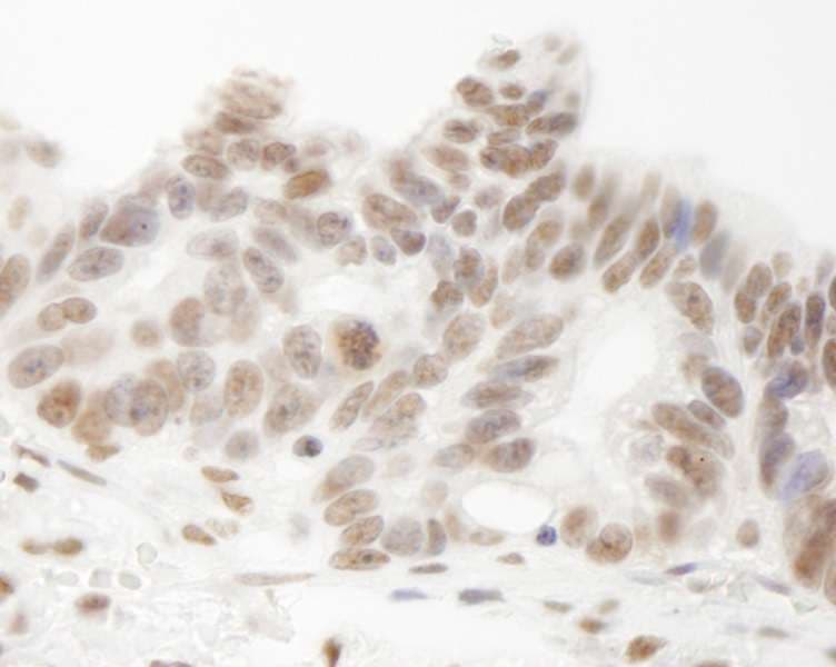 HNRNPUL1 Antibody (aa50-100)