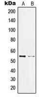 KLF11 Antibody (N-Terminus)