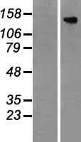 TBC1D4 / AS160 Protein (Over-Expression Lysate Myc-DDK (Flag))