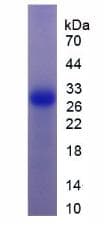 Human GZMK / Granzyme K Protein (Recombinant His)
