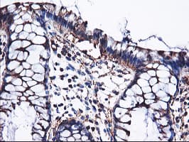PFKP Antibody (clone OTI2E8, Carrier-free)