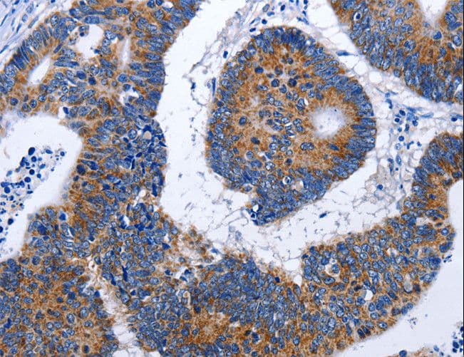 EF1G / EEF1G Antibody