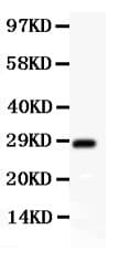 SYCP3 / SCP3 Antibody (aa18-223)