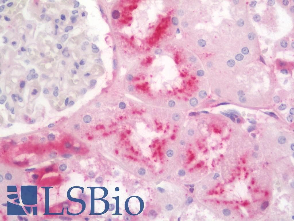 GC / Vitamin D-Binding Protein Antibody (FITC)