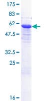 Human EXOSC7 Protein (Recombinant GST)