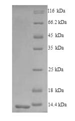 Mouse CCR5 Protein (Recombinant 6His, N-terminus)