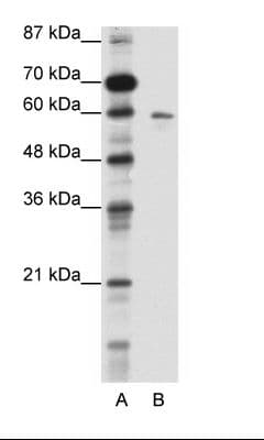 K13 / KCNG Antibody (N-Terminus)