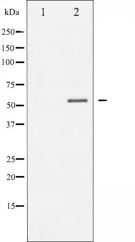 MEF2A / MEF2 Antibody (phospho-Thr319)