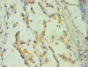SPINT1 / HAI-1 Antibody (aa250-529)