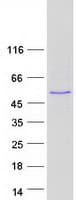 Human ABLIM2 Protein (Recombinant Myc-DDK (Flag))