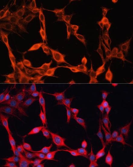 Polyclonal Rabbit anti-Human SLC25A23 Antibody (IF)