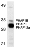 Gestrinone Antibody