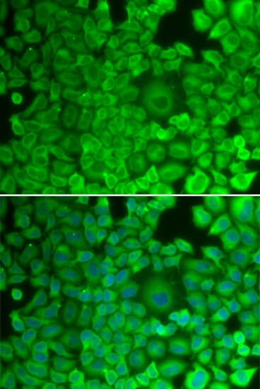 IHC-plus™ GYS1 / Glycogen Synthase Antibody