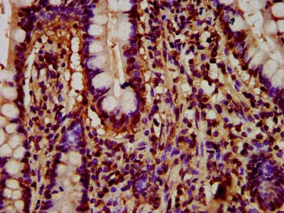 HIST1H4I Antibody