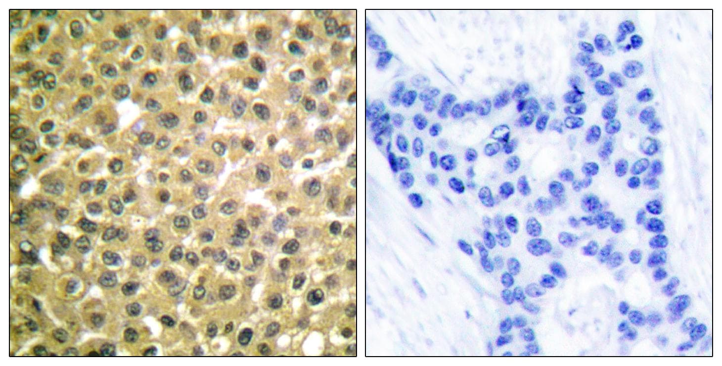 RARB / RAR Beta Antibody
