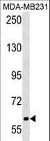 Polyclonal Rabbit anti-Human TRPC4AP / TRUSS Antibody (aa49-75, WB)