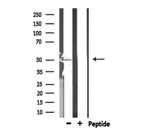 CFH / Complement Factor H Antibody