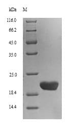 Human CLEC4C / CD303 / BDCA-2 Protein (Recombinant 6His, N-terminus)