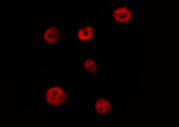 Polyclonal Rabbit anti-Human POU2F1 / OCT1 Antibody (IHC, IF, WB)