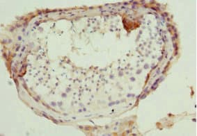 DR1 / NC2 Antibody